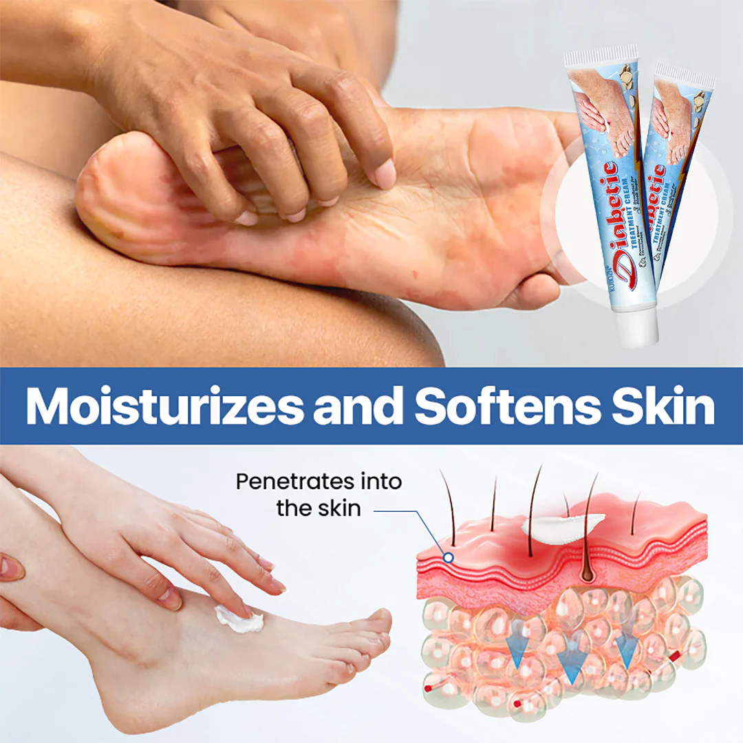 KUBOZNĀ®VitaGluco Diabetes Treatment Cream -šØāāļøDermatologist-Recommended Formula - Image 6